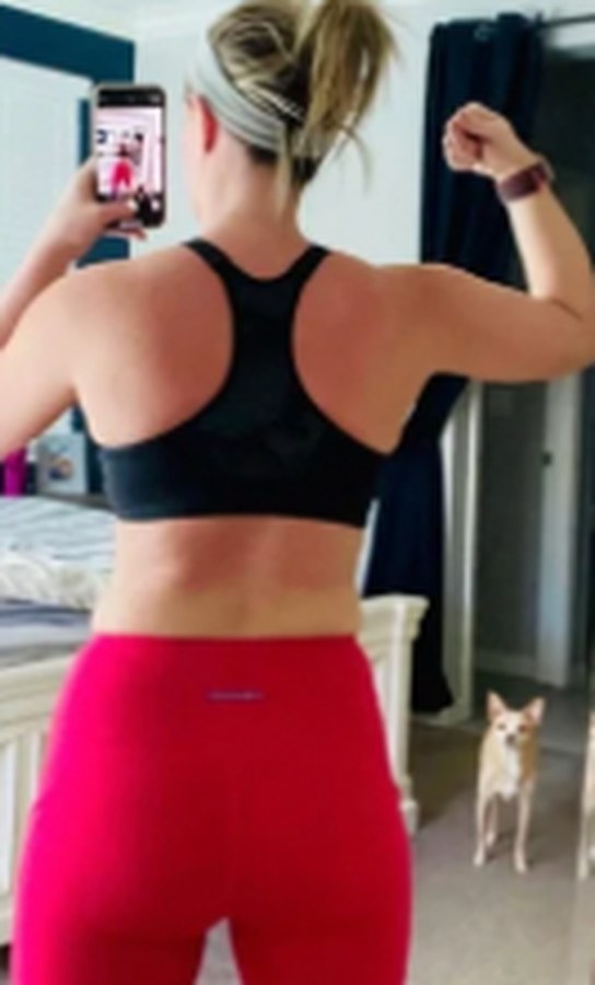 CryoSkin client after, back
